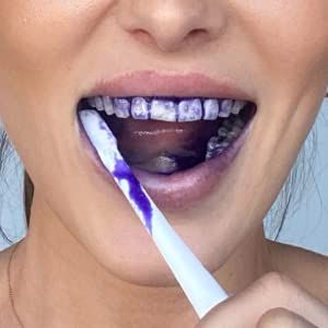 HiSmile V34 Teeth Serum
