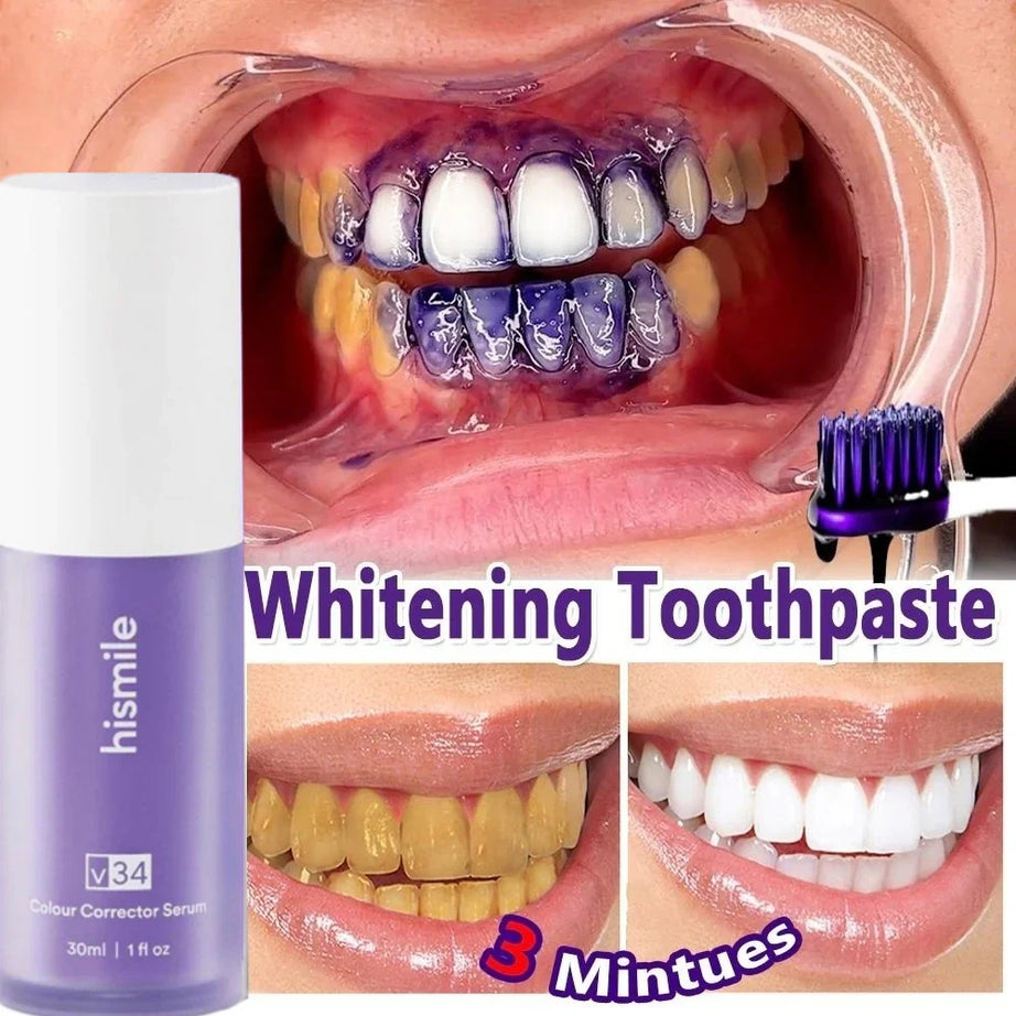 HiSmile V34 Teeth Serum